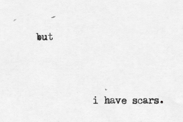 but i have scars. 