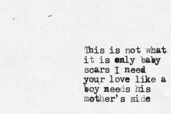 This is not what it is only baby scars I need your love like a boy needs his mother's side 