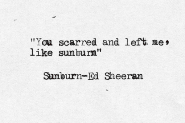 "You scarred and left me like sunburn" , Sunburn— -Ed Sheeran 