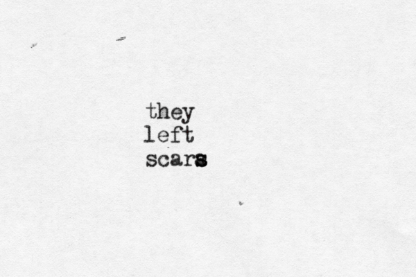 they left scara s s 