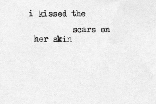 i kissed the scars on her skin 