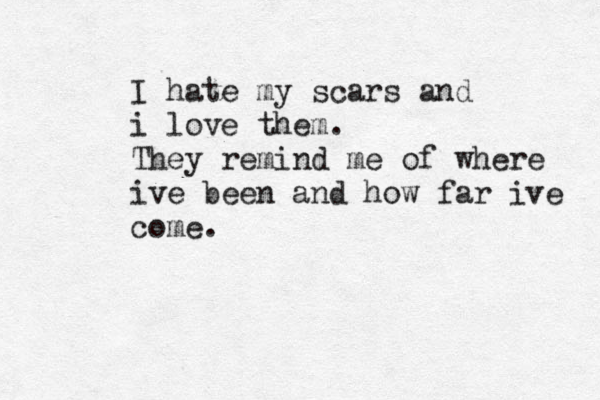 I hate my scars and i love them. They remind me of where ive been and how far ive come. 