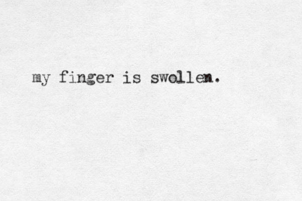 my finger is swollen.