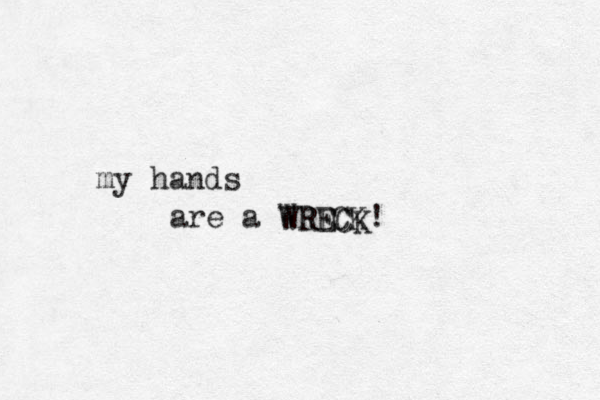 my hands are a WRECK! WRECK 