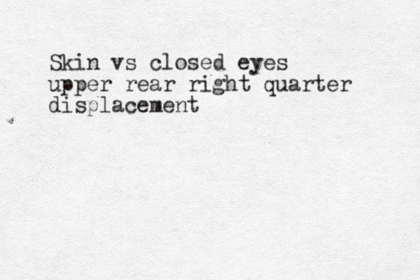 Skin vs closed eyes upper rear right quarter displacement 