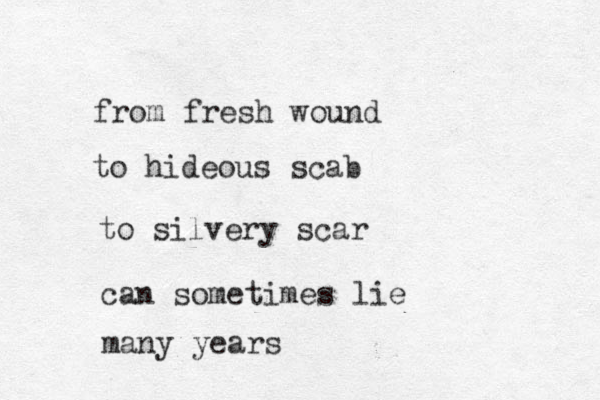 from fresh wound to hideous scab to silvery scar can sometimes lie many years 