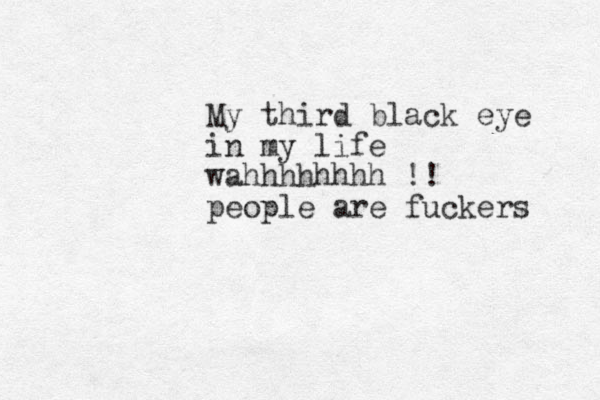 My third black eye in my life wahhhhhhhh !! people are fuckers 