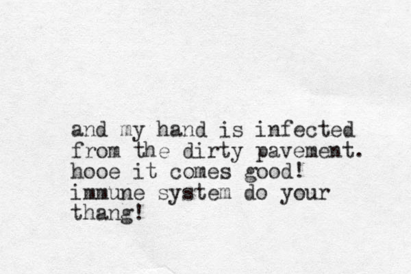 and my hand is infected from the dirty pavement. hooe it comes good! immune system do your thang!