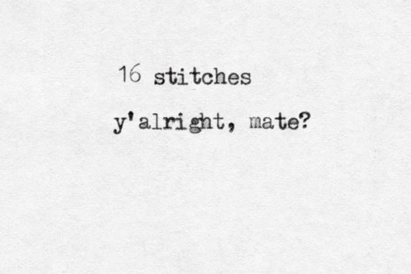 16 stitches y'alright, mate?